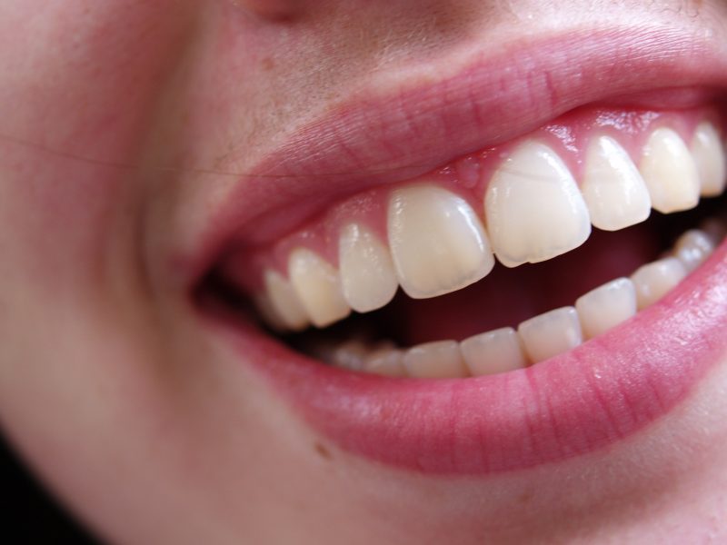 Transform Your Smile with Cosmetic Dentistry Near Toms River, NJ for Lasting Confidence