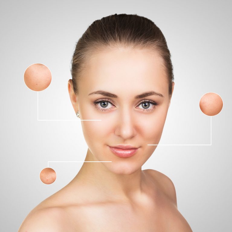 Electrolysis Hair Removal: Need to Know Facts
