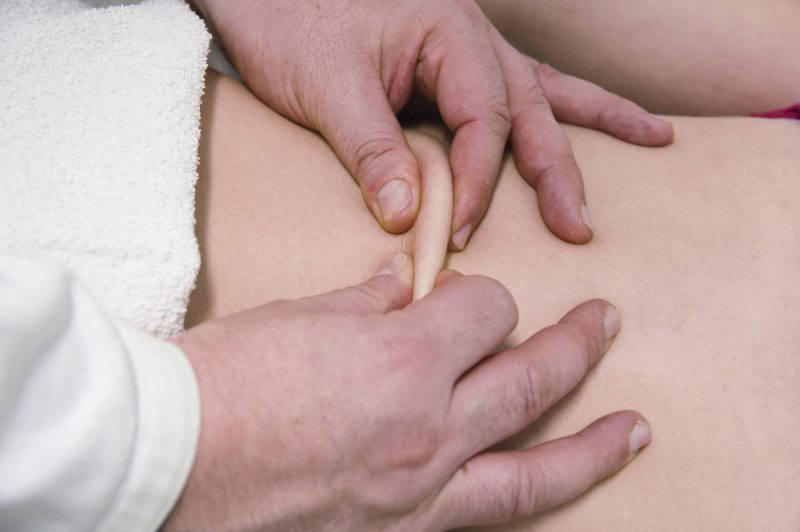Find Great Relief from Expert Acupuncturists
