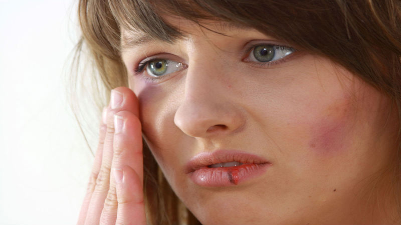 FAQs a Domestic Violence in Mankato Can Answer