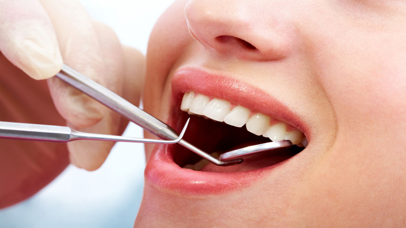 When Should I Choose Dental Implants?