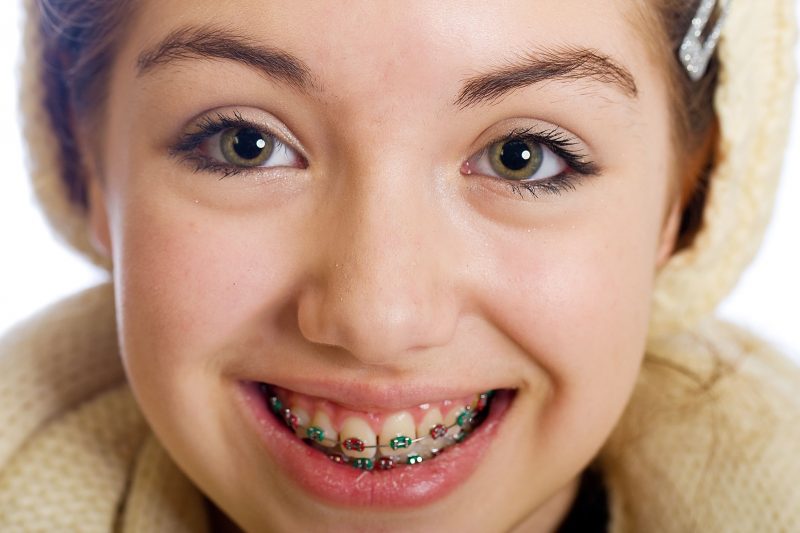 What Are the Benefits of Seeking Orthodontic Treatment in Basking Ridge NJ?