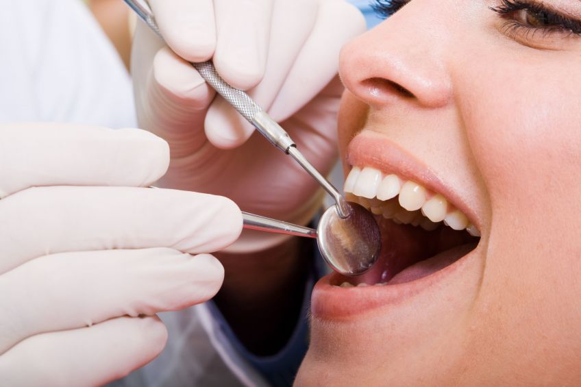 Top Reasons You Should Talk to Your Dentist About Dental Implants
