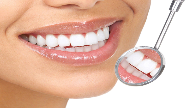 Get a Brighter Smile with Teeth Whitening in Kelowna