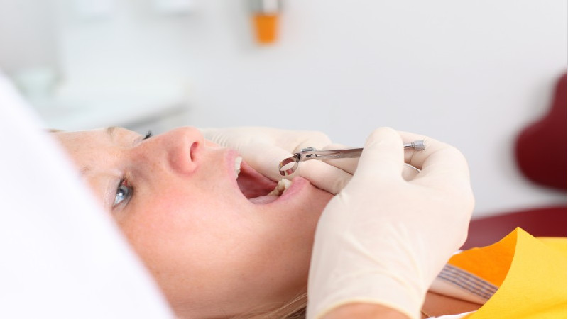 Finding a Dental Center in Macon, GA