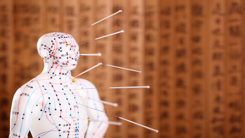 Three Benefits You Might Experience From A Acupuncture Treatment In Scottsdale AZ