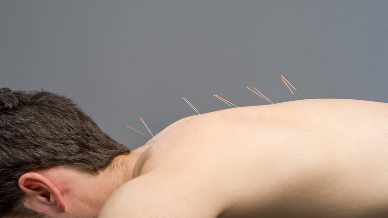 How Acupuncture In Costa Mesa CA Can Help With Headaches And Insomnia