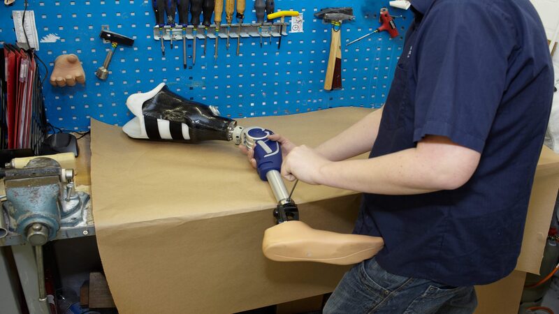 Innovative Prosthetic Arm in Twin Falls, ID: Enhancing Lives And Restoring Independence