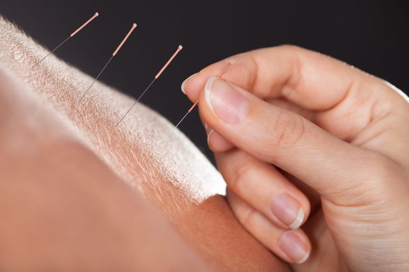 Discover the Leading Acupuncture Fertility Specialists in Burbank, CA, to Transform Your Parenthood Journey