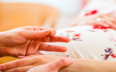 Reclaim Your Peace of Mind: Acupuncture for Stress in Bellingham, WA