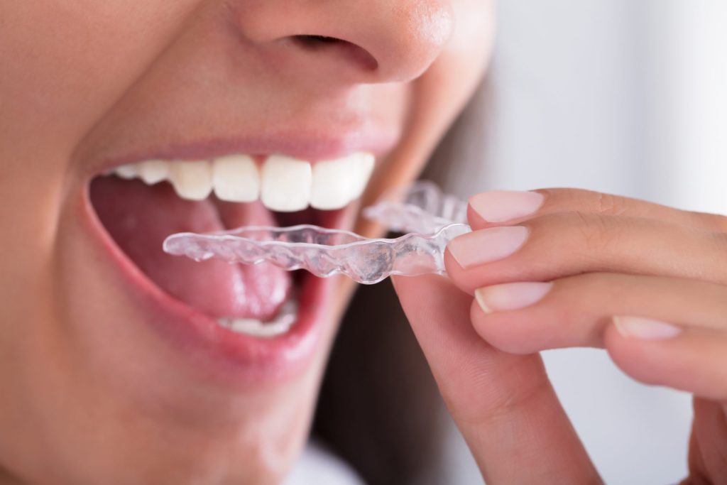 Choosing An Orthodontist In Medina OH For Personalized Care And Confident Smiles