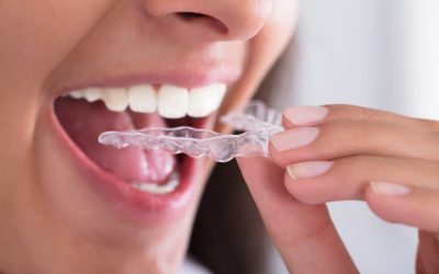Choosing An Orthodontist In Medina OH For Personalized Care And Confident Smiles